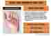 65679-2 Jolly Green Products Eco-orange Xxl Bbq Grilling Most Versatile Oven Mitts Hot Lifetime Loved Andrew